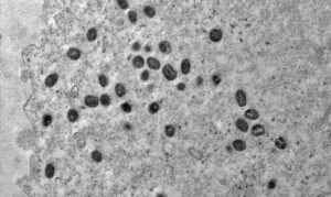 OMS faz alerta para variante perigosa da "varíola dos macacos" » Portal MaisVip