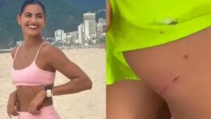 Atriz Letícia Salles é mordida por cachorros enquanto corre na praia