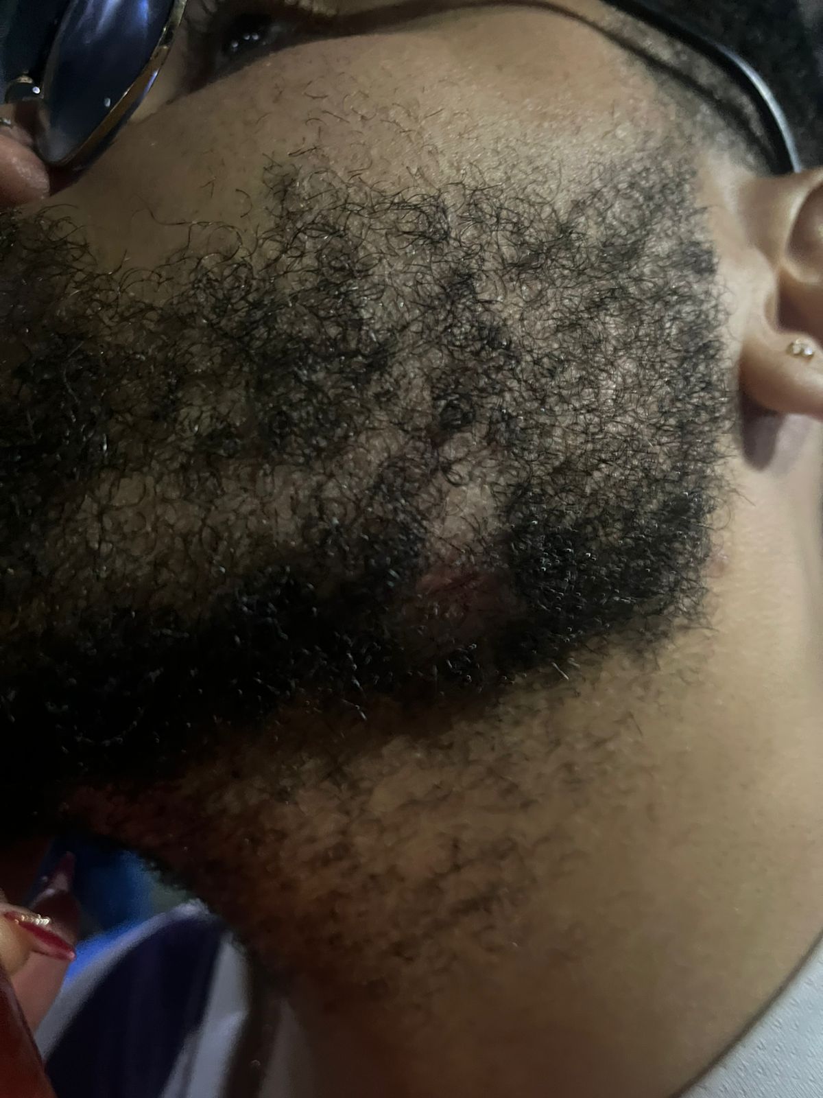 Guilherme Guerra foi agredido por policiais no Mineiro