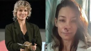 Evangeline Lilly, famosa por 'Lost', revela acidente grave na praia