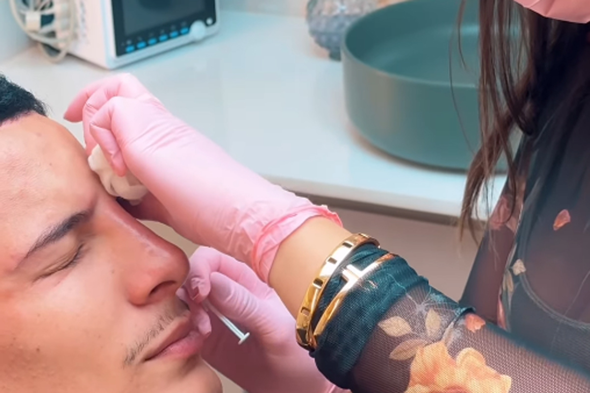Arana em procedimento de harmonizao facial - (foto: Reproduo/Instagram) Arana em procedimento de harmonizao facial - (foto: Reproduo/Instagram)
