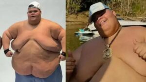 Gordão da XJ revela nova meta após emagrecer 75 kg: andar de elevador