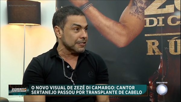 Veja o novo visual de Zezé Di Camargo após transplante capilar - Domingo Espetacular