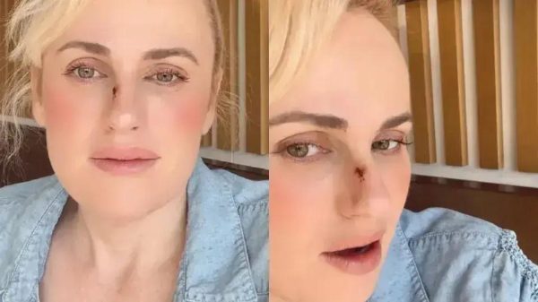 Rebel Wilson relembra acidente em 'Bride Hard' e impacto na filmagem