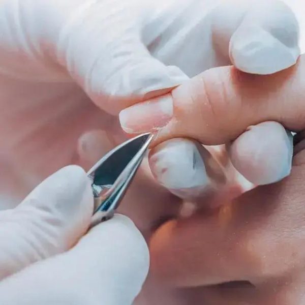 Timóteo oferece capacitação sobre prevenção de doenças em estética